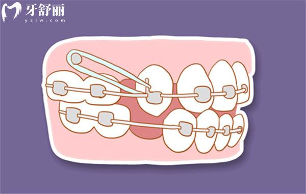 保山口腔醫(yī)院收費標(biāo)準(zhǔn)表