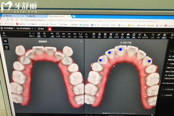 天津愛之和口腔方案設(shè)計(jì)