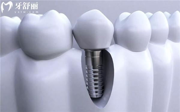 漢中口腔醫(yī)院價(jià)目表
