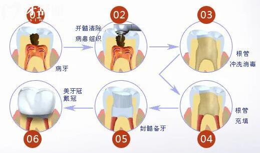 牙博士口腔醫(yī)院收費貴嗎現(xiàn)在?2025年種植牙價格1980矯正4500靠譜又實惠