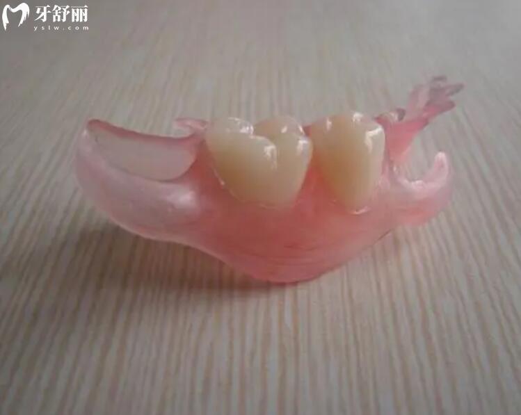 活動(dòng)義齒