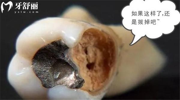 爛牙根長期不拔的危害