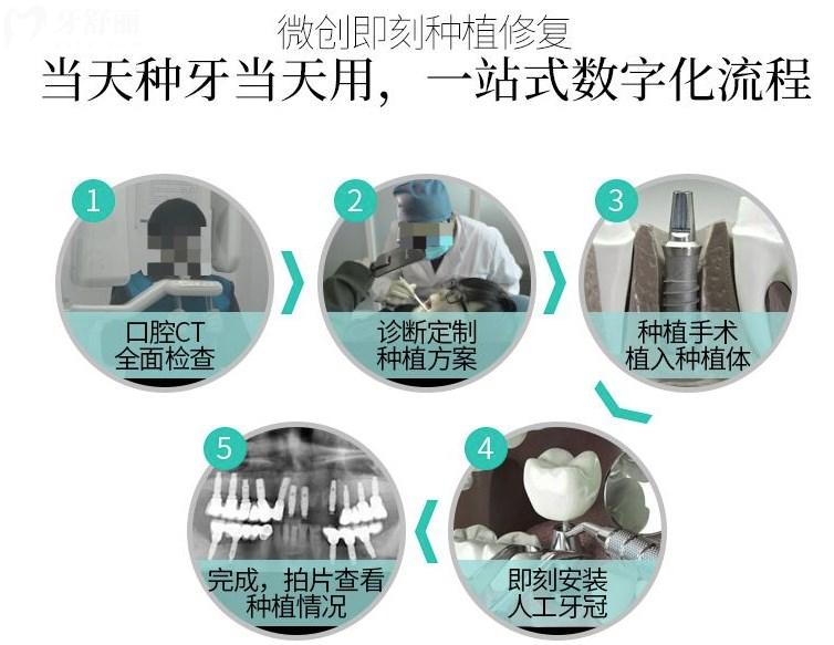 即刻種植牙過(guò)程