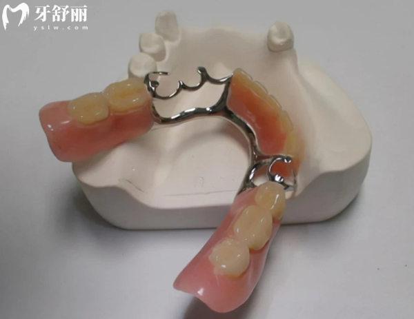 順義區(qū)醫(yī)院鑲牙多少錢(qián)