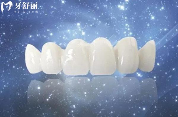 天津**全瓷牙多少錢一顆