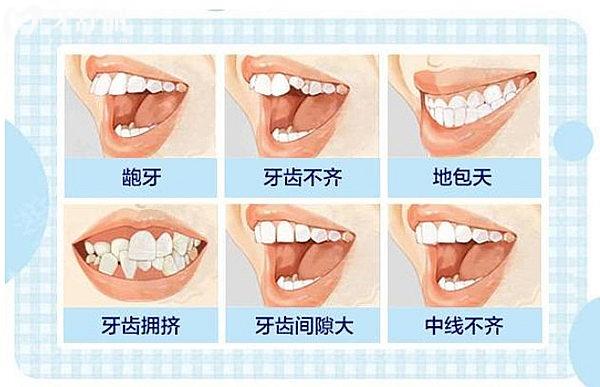 保定二醫(yī)院牙科牙齒矯正的費用