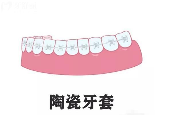 吳江正規(guī)口腔醫(yī)院價格收費(fèi)標(biāo)準(zhǔn)