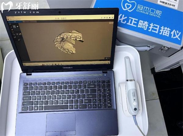 涿州冠杰朗朗口腔正畸掃描儀