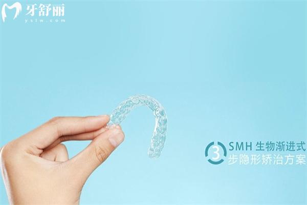 透舒麗隱形矯治器