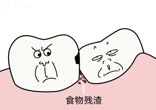 導致鄰面齲齒的原因有哪些