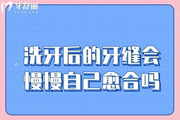洗牙后的牙縫會(huì)慢慢自己愈合嗎？