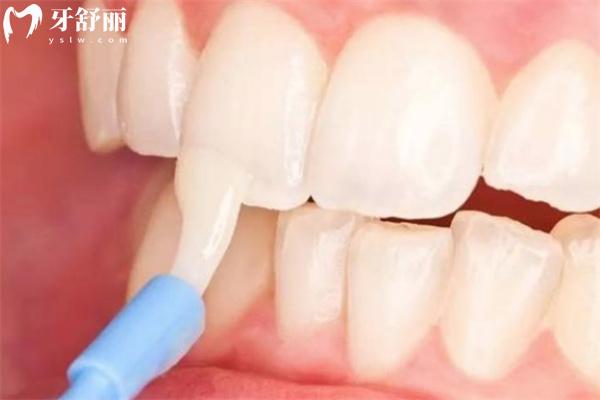 牙齒脫礦是什么原因造成的