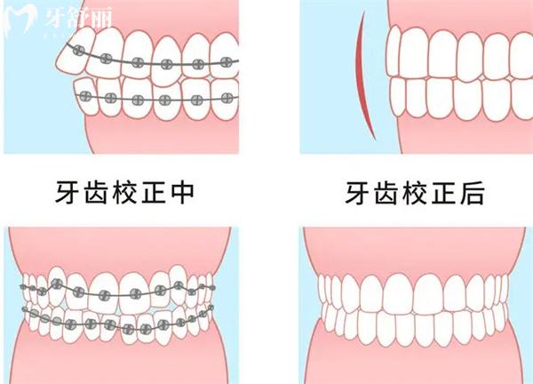 天津?yàn)I海新區(qū)牙科牙齒矯正多少錢