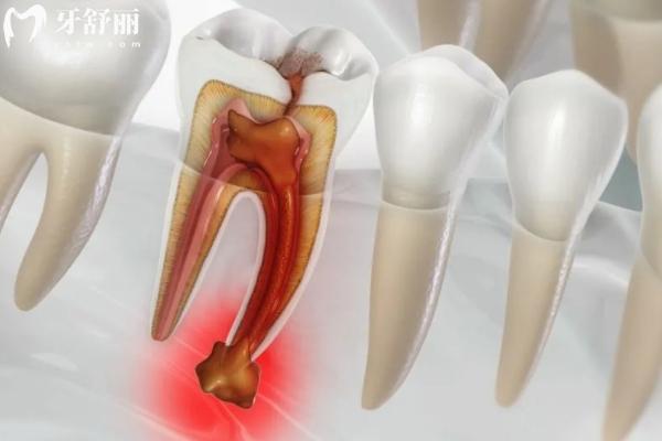 烏魯木齊牙科價格表