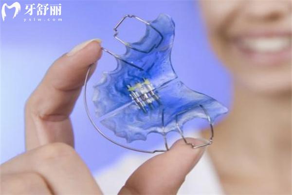 兒童幾歲可以戴擴弓器更適合