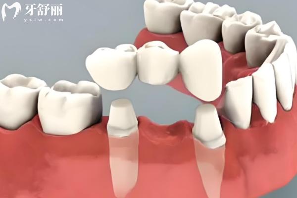 高安牙科收費標準