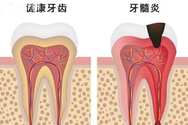 牙疼和壓力大有關(guān)系嗎？