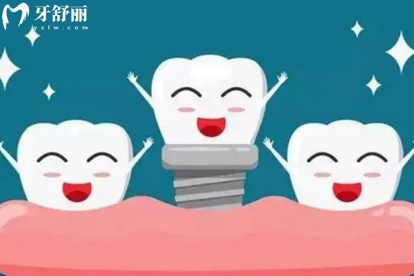 宣城種牙多少錢一顆?國產(chǎn)/韓國/美國/德國/瑞典4000-16000價格公布