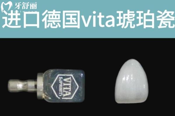 ??VITA琥珀瓷貼面