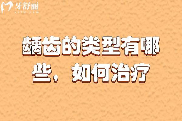 齲齒的類型有哪些？齲齒該如何治療？