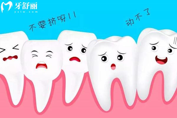 牙齒矯正26歲還來(lái)得及嗎