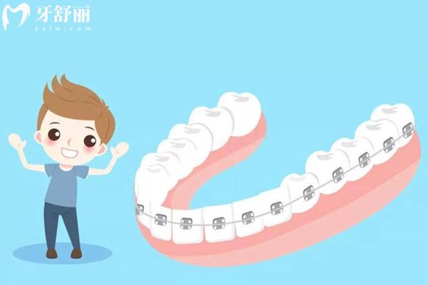 牙齒矯正26歲還來(lái)得及嗎