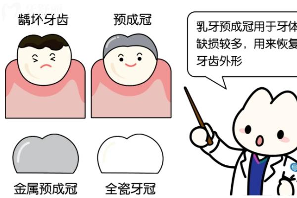 乳牙磕斷了一半怎么辦？直接拔掉還是修復(fù)？