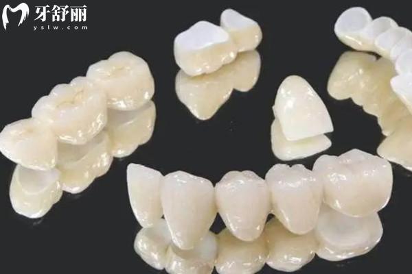 愛(ài)爾創(chuàng)全瓷牙冠質(zhì)保幾年
