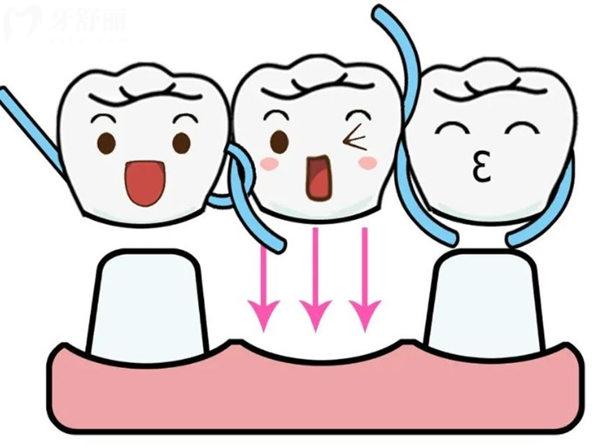 西寧鑲?cè)裳纼r(jià)格多少錢(qián)一顆？