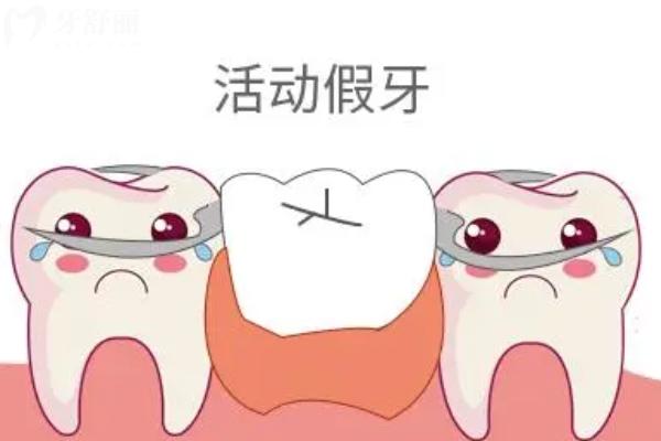 上海裝活動(dòng)假牙多少錢