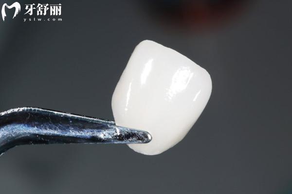 牙齒貼面可以用醫(yī) 保嗎？