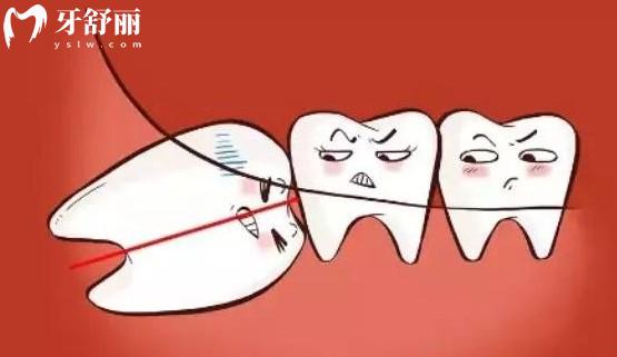 簡單智齒和復(fù)雜智齒如何判斷？