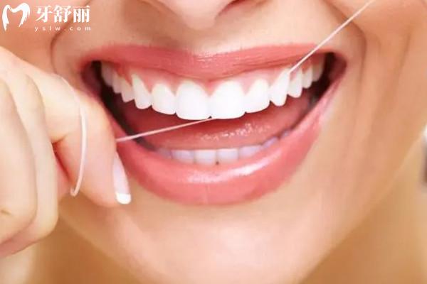 牙齒貼面時(shí)間長(zhǎng)了會(huì)掉嗎