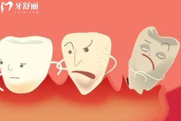 先洗牙還是先拔牙補牙？