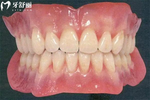 國(guó)內(nèi)常用全口義齒種類有哪些？大概多少錢一副？