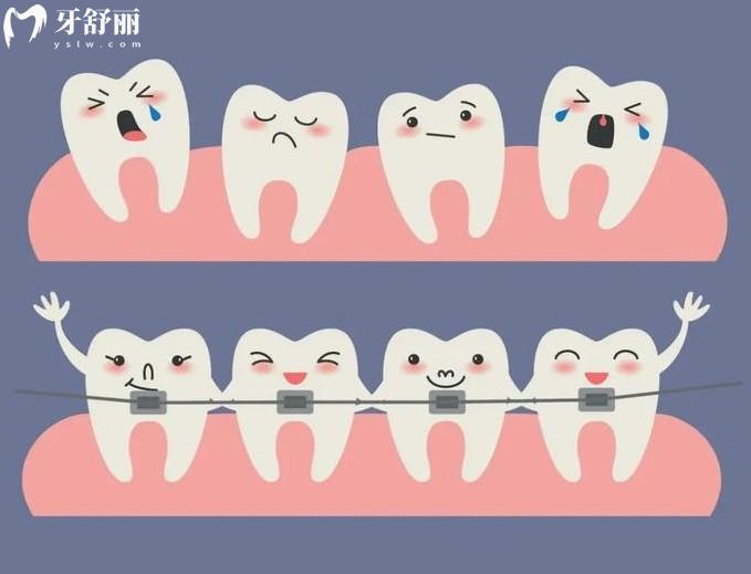 燕郊牙科診所牙齒矯正價(jià)格表