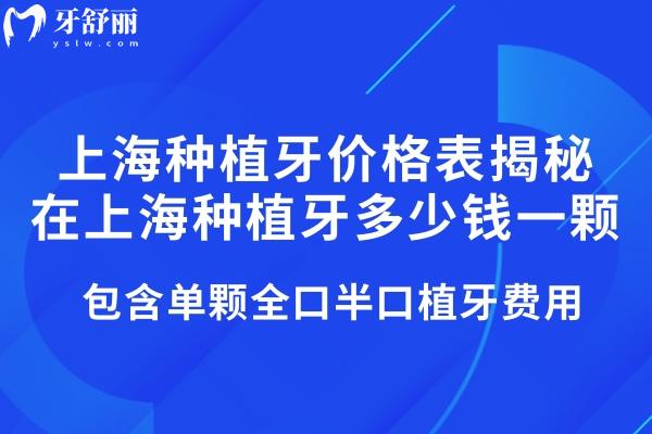 2025上海種植牙價(jià)格表揭秘在上海種植牙多少錢(qián)一顆!包含單顆全口半口植牙費(fèi)用