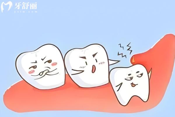 邵陽拔智齒要花多少錢？