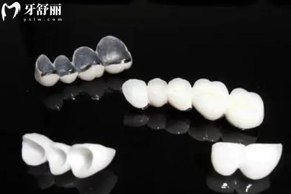 宿遷看牙貴不貴？宿遷口腔醫(yī)院價(jià)格表