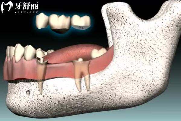西寧時光諾貝爾口腔收費標準更新