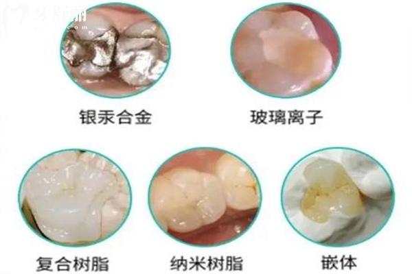 許昌口腔醫(yī)院牙科收費價目表