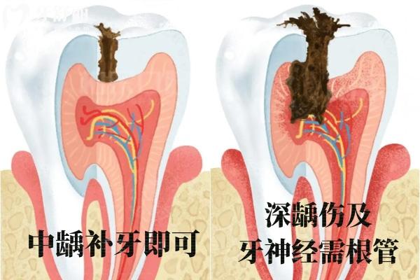 許昌口腔醫(yī)院牙科收費價目表