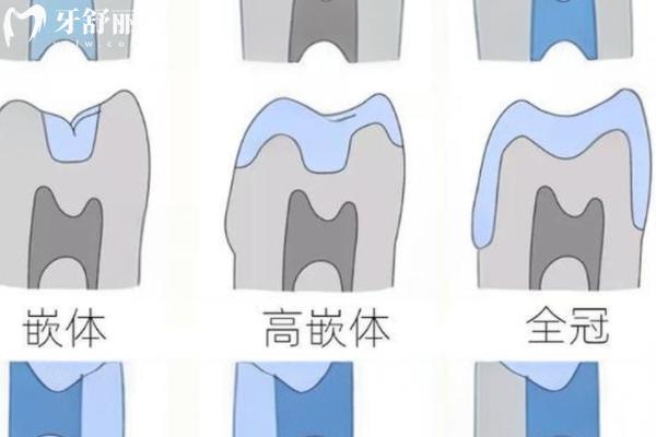 寧波北侖口腔醫(yī)院價格貴嗎?