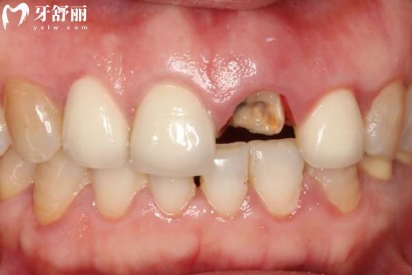 鎮(zhèn)江各大口腔醫(yī)院收費價目表