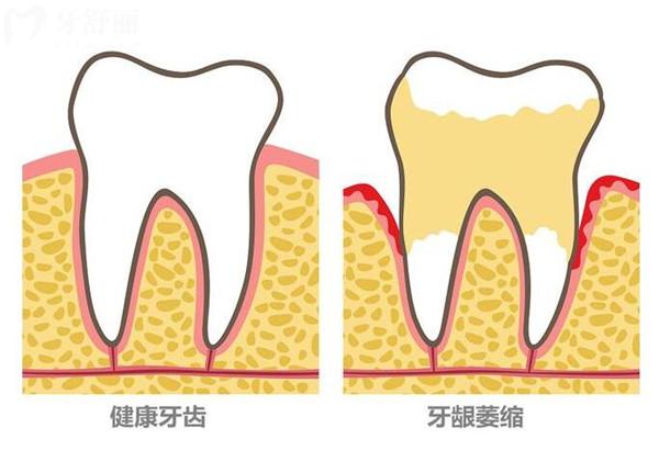南通美特美口腔收費價格表