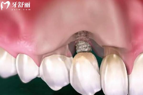 延吉韓世口腔醫(yī)院是正規(guī)醫(yī)院嗎