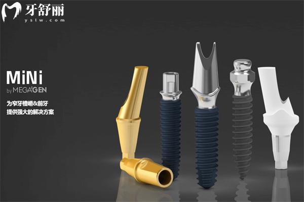 青島種植牙多少錢一顆2025價(jià)格表已出 單顆牙2k元+全口種牙3.6w元+