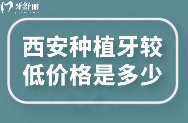 西安種植牙較低價(jià)格是多少