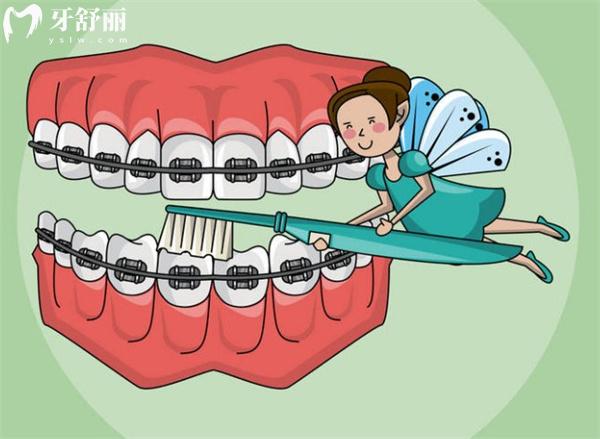 石家莊口腔醫(yī)院牙齒矯正費用