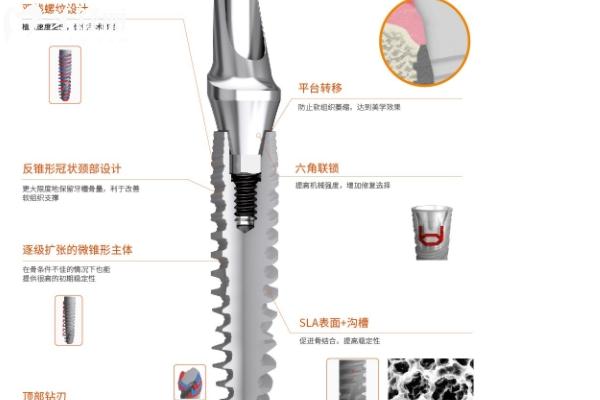2025年?？诜N植牙價格表公開